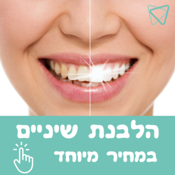 הלבנת שיניים smart dental הלבנת שיניים smart dental