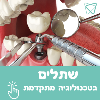 שתלים smart dental שתלים smart dental