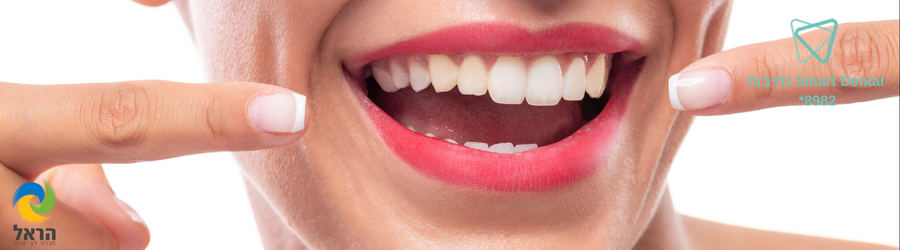 השתלת שיניים בסבסוד משרד הביטחון – כל מה שצריך לדעת